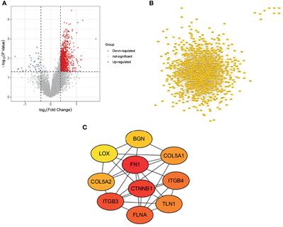 COL5A2 Inhibits the TGF-β and Wnt/β-Catenin Signaling Pathways to Inhibit the Invasion and Metastasis of Osteosarcoma